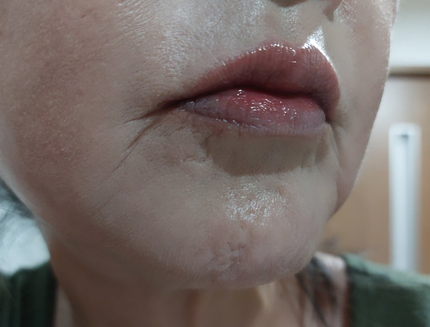 ボリュームリッププランパー/BANILA CO/リッププランパーを使ったクチコミ(4枚目)