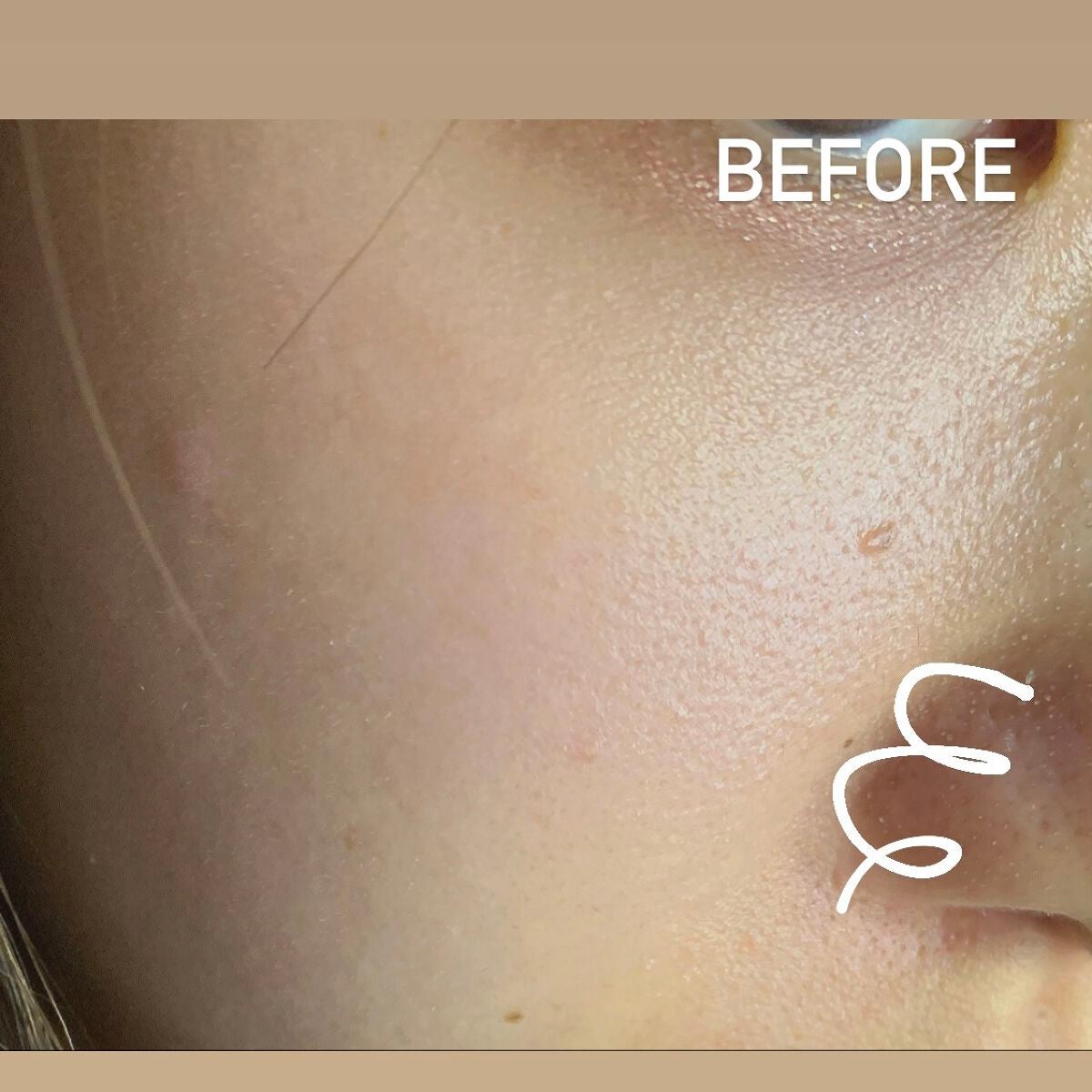 【旧】ディオールスキン フォーエヴァー スキン コレクト コンシーラー/Dior/リキッドコンシーラーを使ったクチコミ(2枚目)