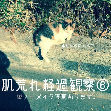 寒くなってきて近所の猫なかなか見かけられなくなってきました。

ニキビ跡と赤みがちょい気になるけど、ニキビは出来なくなって数日。生理直前ですが荒れはほぼなし。乾燥は若干あり…

ビタCセラムなくなったの