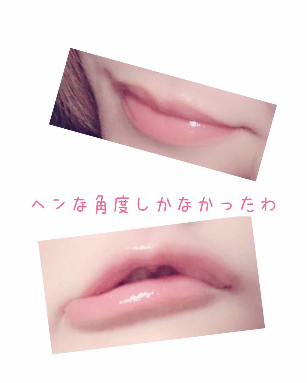 モアリップ N (医薬品)/資生堂薬品/その他を使ったクチコミ(1枚目)