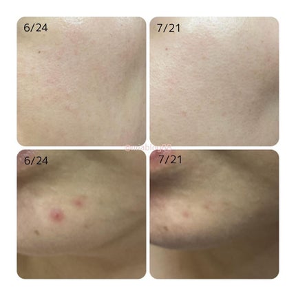 Ultra Whitening Perfect Ampoule/MIGUHARA/美容液を使ったクチコミ(2枚目)