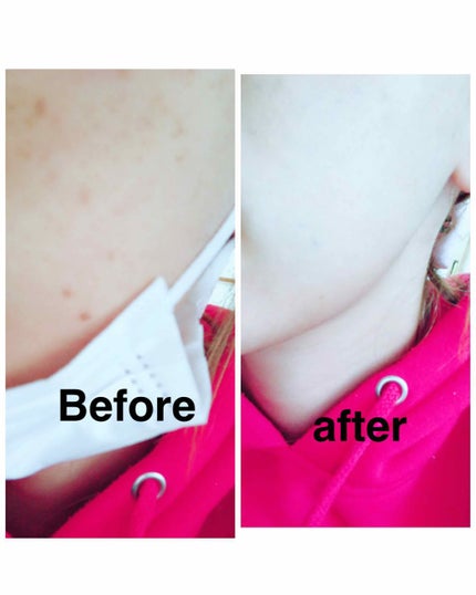 ノエビア レイセラ 薬用ブライトニング コンシーラーUVのクチコミ「ノエビア
レイセラ 薬用ブライトニングコンシーラーUV
ノエビアさんのレイセラシリーズから.....」(2枚目)