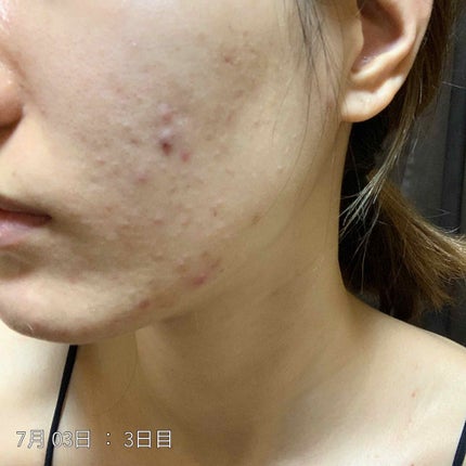 ハトムギ保湿ジェル(ナチュリエ スキンコンディショニングジェル)/ナチュリエ/美容液を使ったクチコミ(2枚目)