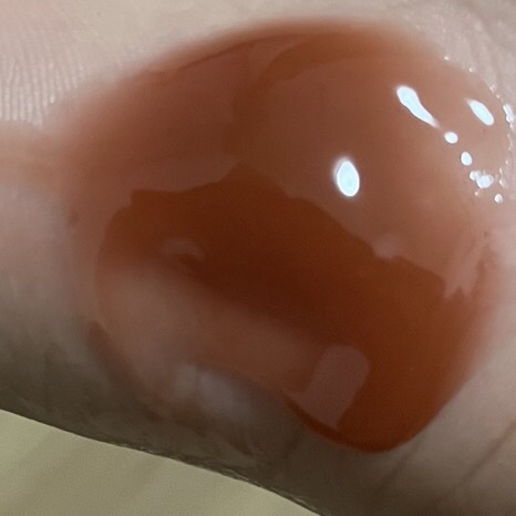 ブラックマグマ ホットクレンジングジェル/ロゼット/クレンジングジェルを使ったクチコミ（2枚目）