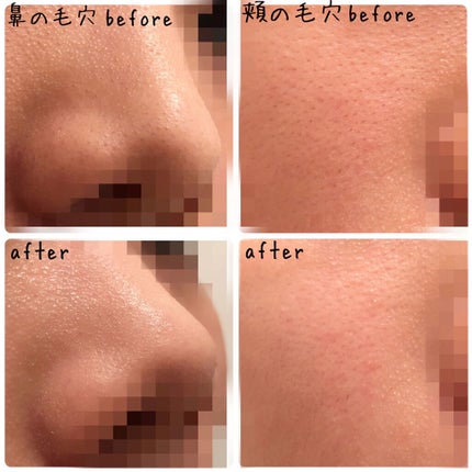 洗顔用泡立てネット/無印良品/その他スキンケアグッズを使ったクチコミ(9枚目)