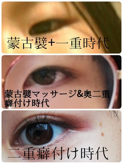 ふたえテープ 目立たず肌になじむ絆創膏タイプ/DAISO/二重まぶた用アイテムを使ったクチコミ(1枚目)