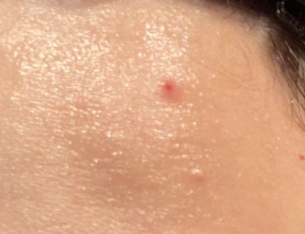 ネイチャーコンク 薬用クリアローション/ネイチャーコンク/拭き取り化粧水を使ったクチコミ(2枚目)