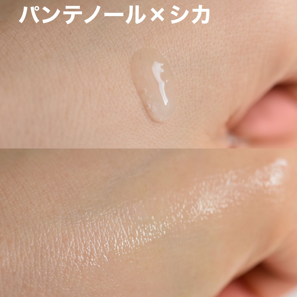 パンテノールシカブレミッシュアンプル/BIOHEAL BOH/美容液を使ったクチコミ（2枚目）