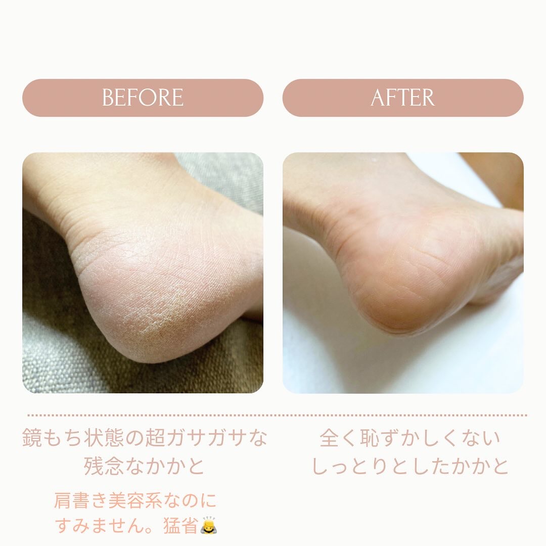 シルキーココナッツオイルフットマスク /MADFORCOS/レッグ・フットケアを使ったクチコミ（2枚目）