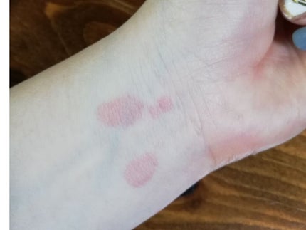 オロナインH軟膏 (医薬品)/オロナイン/その他を使ったクチコミ(2枚目)