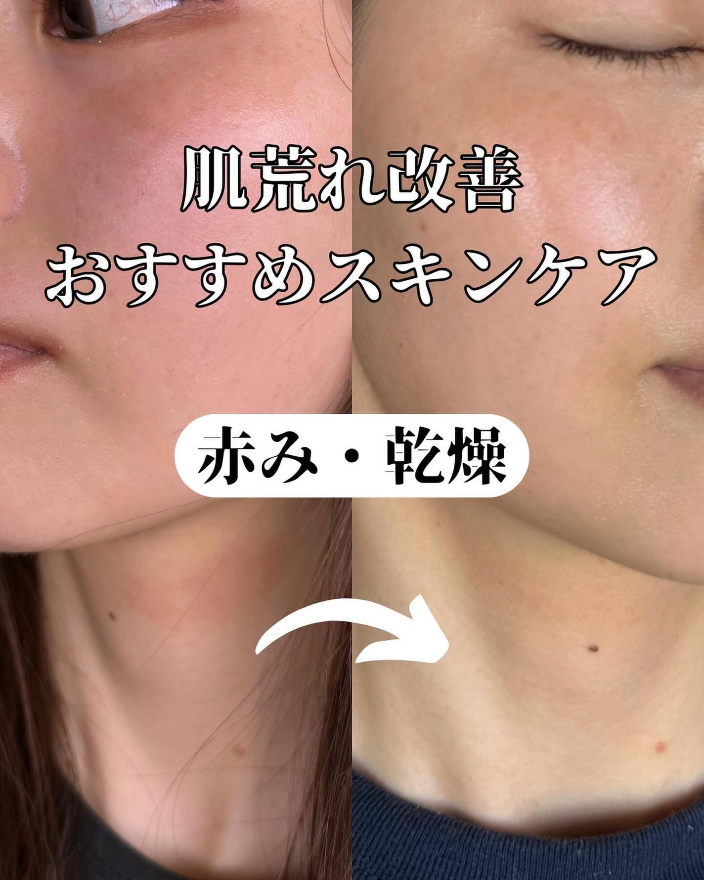 マデカダーママスクⅢ インセンティブフォーミュラ/センテリアン24/シートマスク・パックを使ったクチコミ(1枚目)