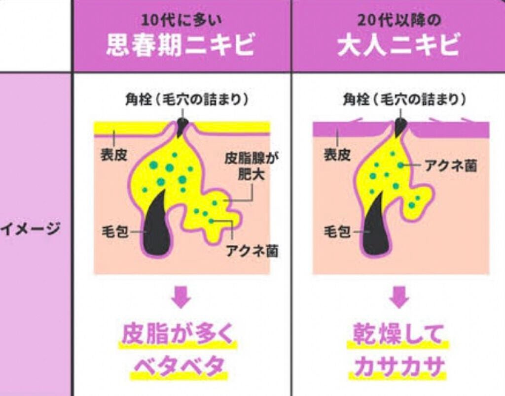 ℳ on LIPS 「投稿を見ていただきありがとうございます😳😳〰️2枚目を参考に、..」(2枚目)