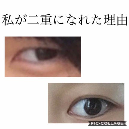 アイトーク/アイトーク/二重まぶた用アイテムを使ったクチコミ(1枚目)