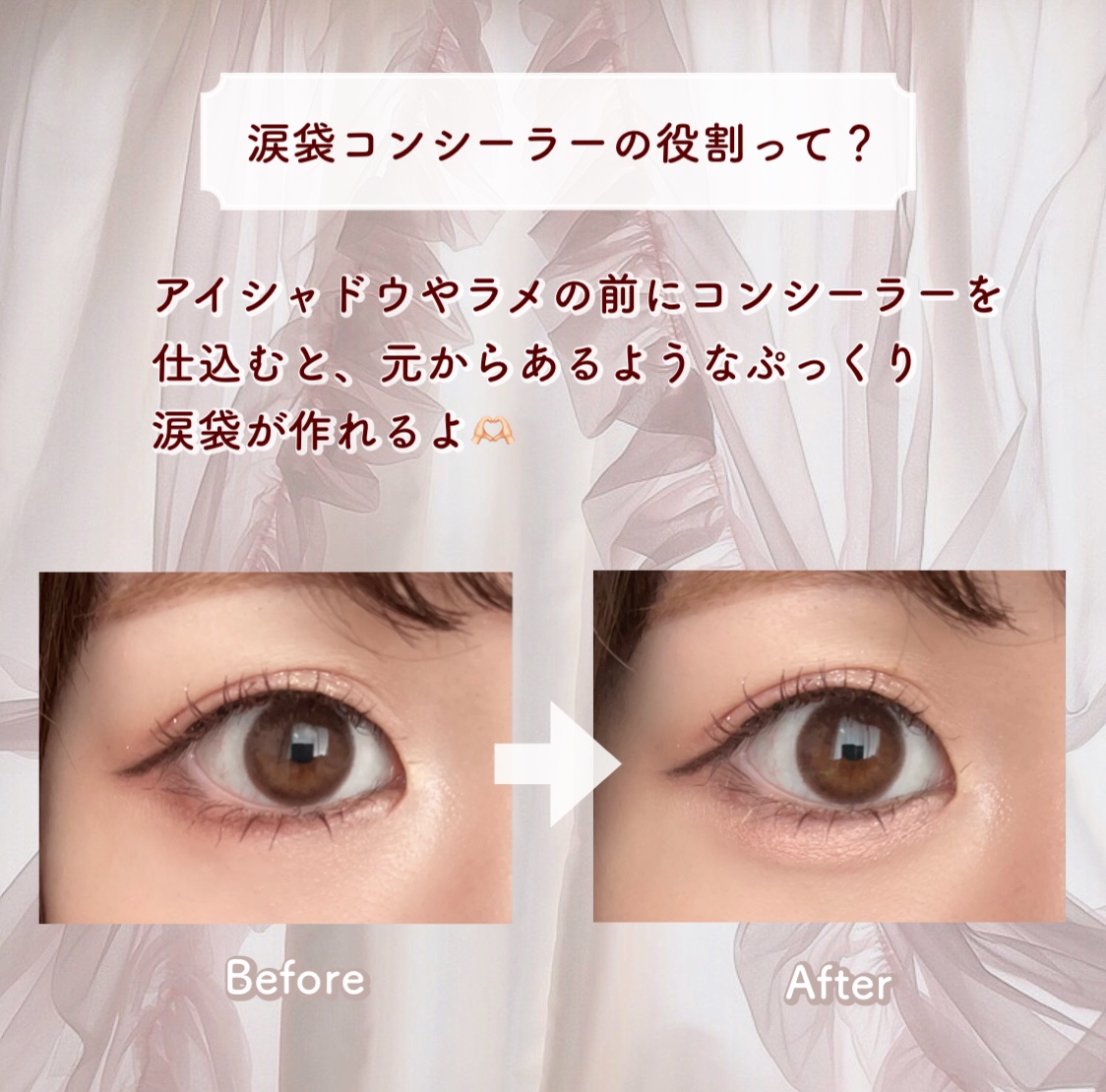 カラーミキシングコンシーラー/キャンメイク/パレットコンシーラーを使ったクチコミ（2枚目）