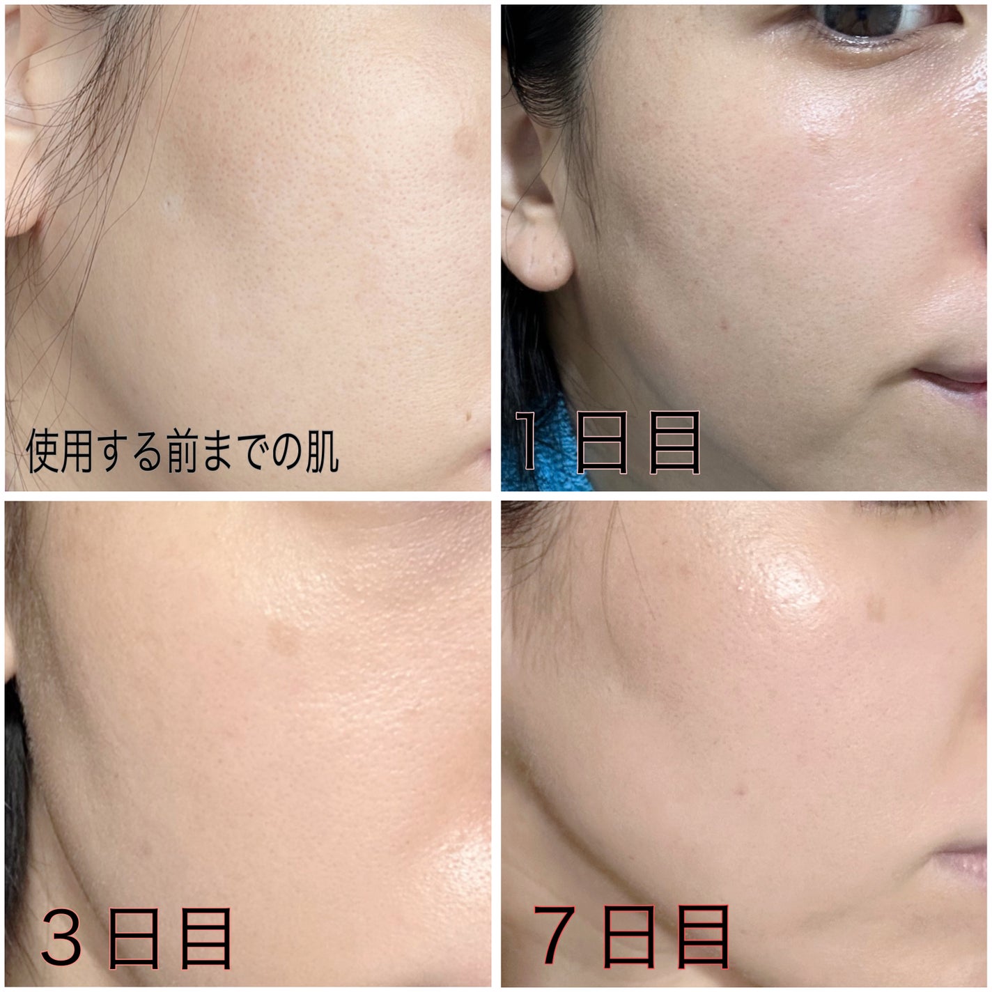 リードルS 100 2ステップマスク/VT/シートマスク・パックを使ったクチコミ(4枚目)