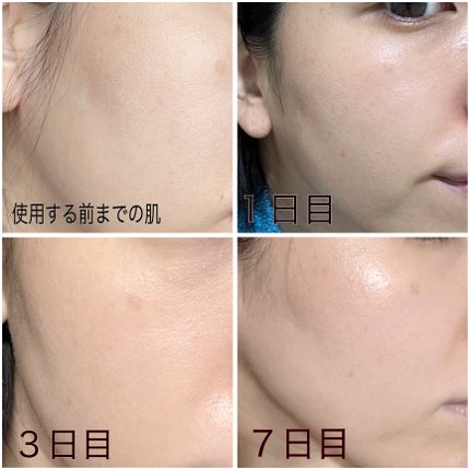 リードルS 100 2ステップマスク/VT/シートマスク・パックを使ったクチコミ(4枚目)