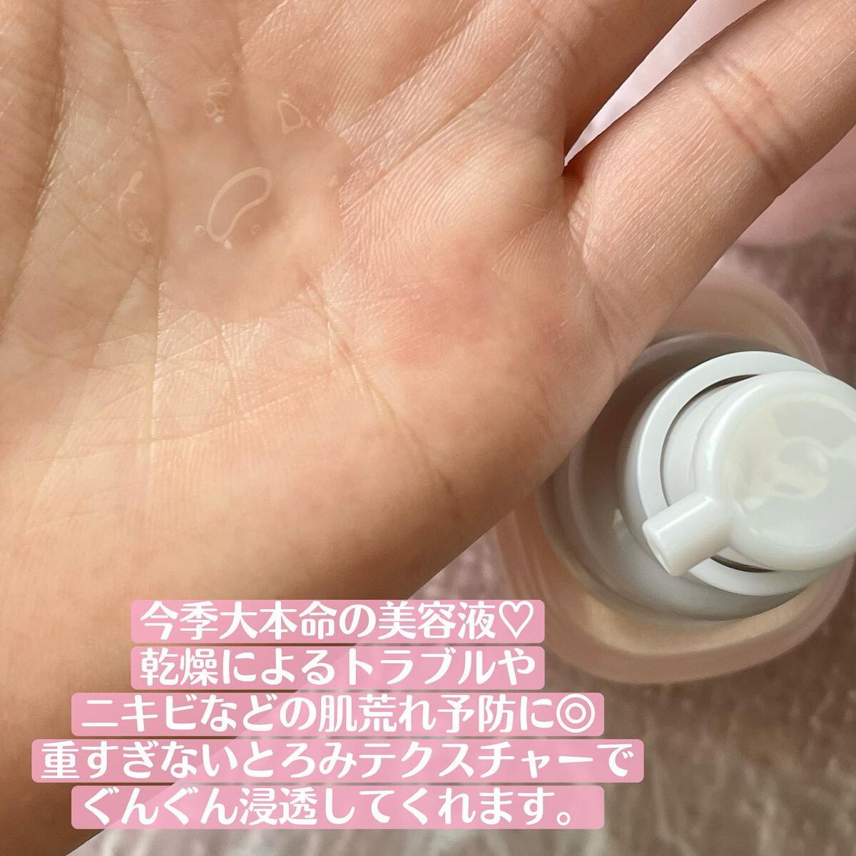 モイストケア ローション MB/d プログラム/化粧水を使ったクチコミ(5枚目)