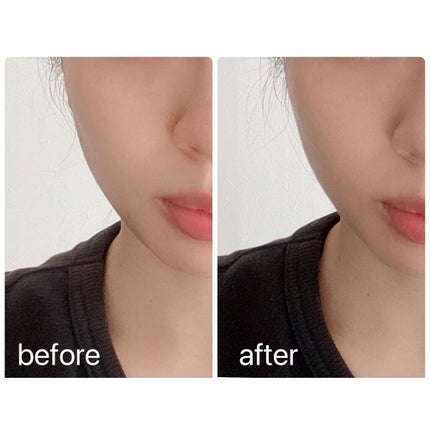 chika♡フォロバ100 on LIPS 「【DR.SOIE5Gリフトファンデーション】サロン専売品『速攻..」(5枚目)