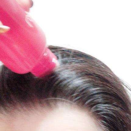 薬用 RJ地肌ケア エッセンス /アピセラピーコスメティクス/頭皮ローションを使ったクチコミ(4枚目)