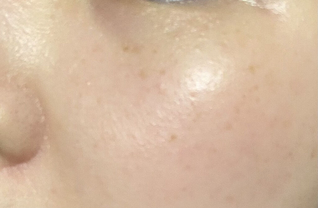 ビフィダバイオームコンプレックスセラム/manyo/美容液を使ったクチコミ（3枚目）