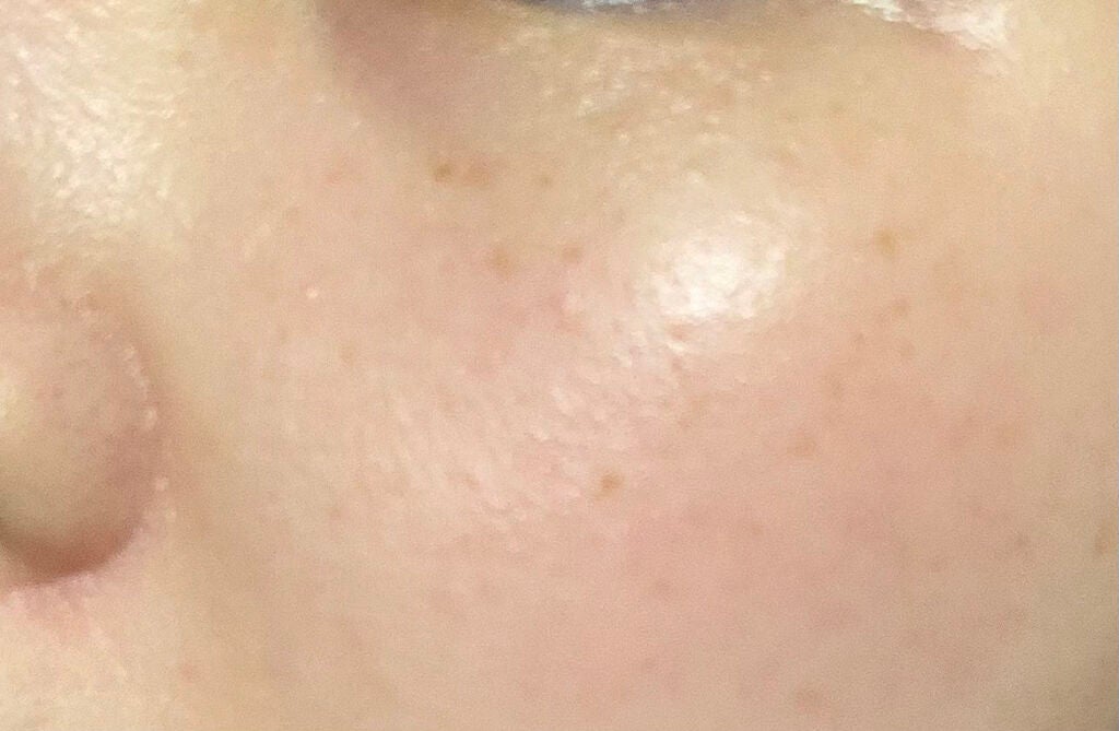 ビフィダバイオームコンプレックスセラム/manyo/美容液を使ったクチコミ(3枚目)