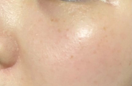 ビフィダバイオームコンプレックスセラム/manyo/美容液を使ったクチコミ(3枚目)