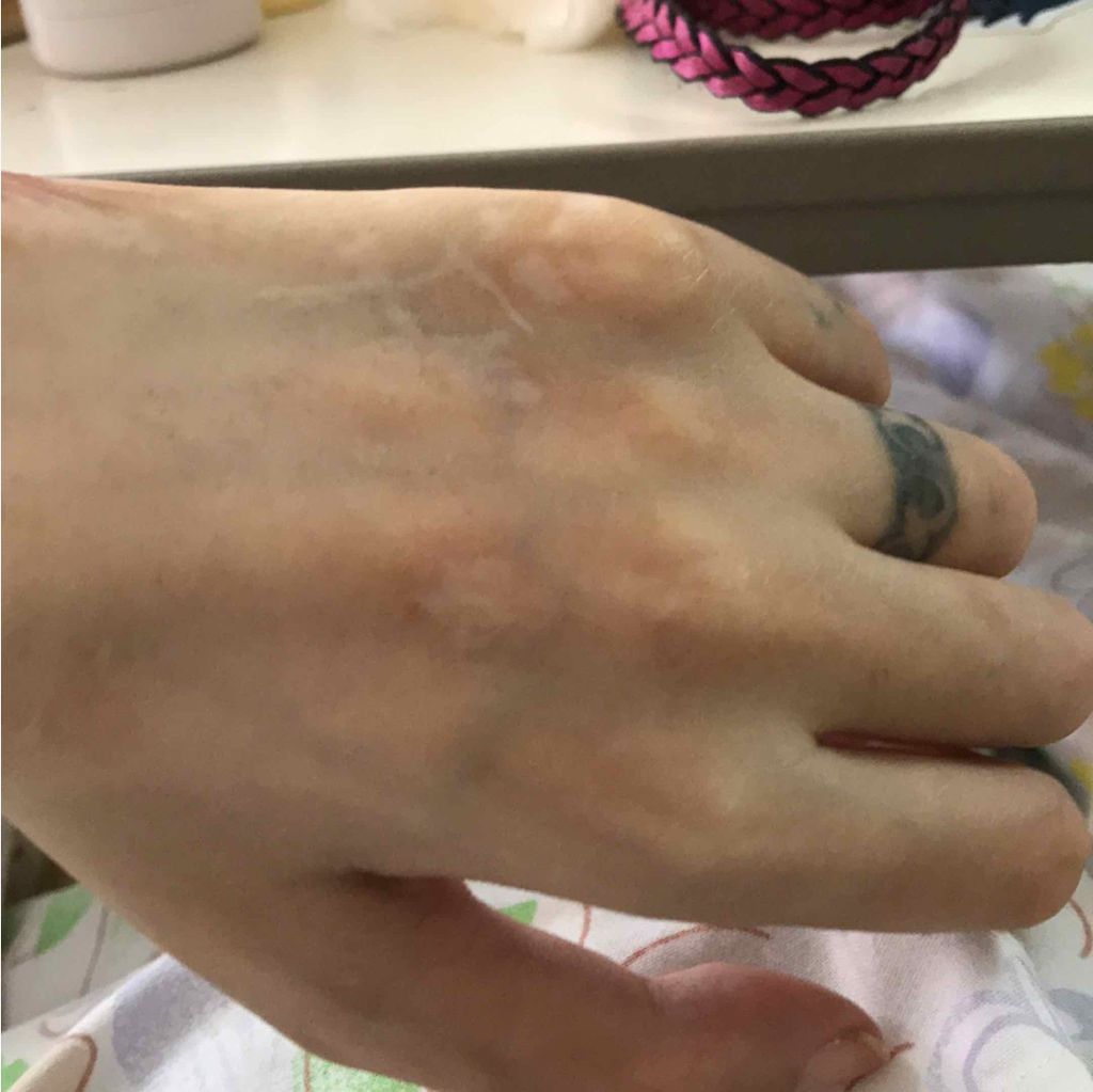 スポッツカバー ファウンデイション/SHISEIDO/クリームコンシーラーを使ったクチコミ(2枚目)