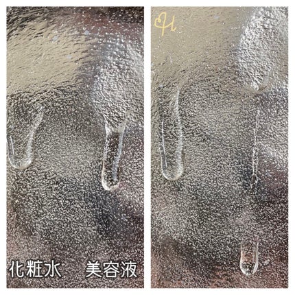 ダーマレーザー ウルセラC/クオリティファースト/美容液を使ったクチコミ(2枚目)