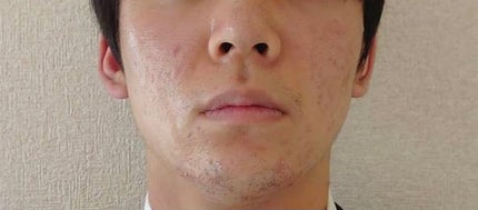 かとう on LIPS 「8/3メモ証明用の写真撮ってみて、去年の12月と比較して感激…..」(2枚目)