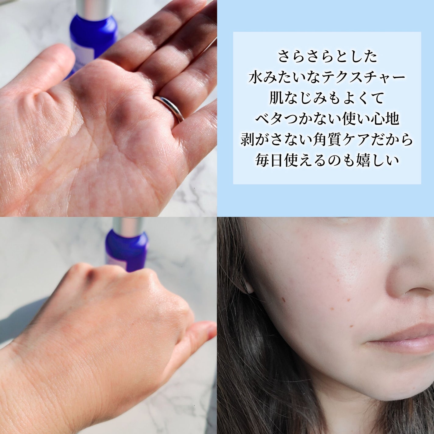 タカミスキンピール/タカミ/ブースター・導入液を使ったクチコミ(3枚目)