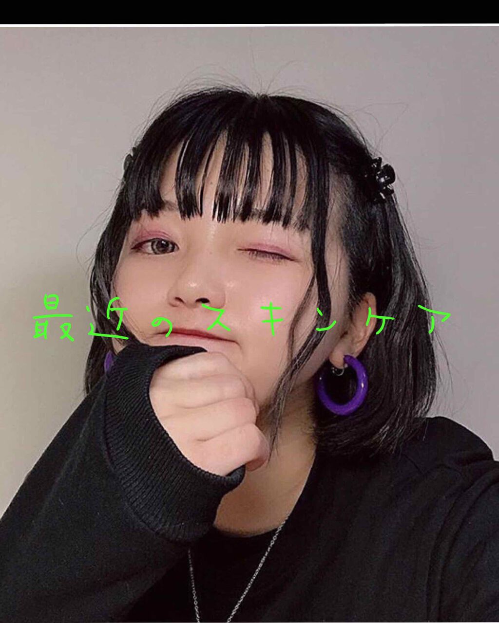 オードムーゲ 薬用ローション（ふきとり化粧水）/オードムーゲ/拭き取り化粧水を使ったクチコミ（1枚目）