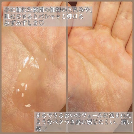 オルビスユー エッセンスローション /オルビス/化粧水を使ったクチコミ(5枚目)