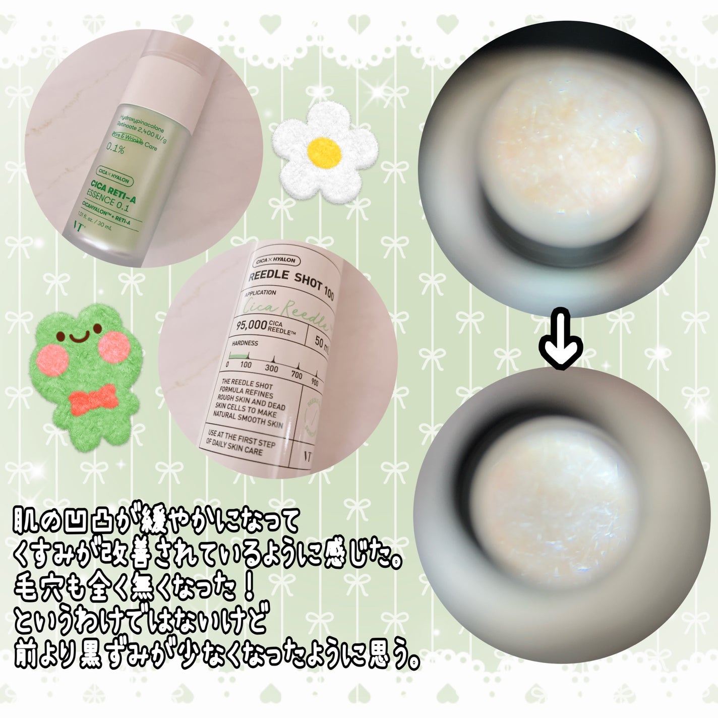 シカレチA エッセンス0.1/VT/美容液を使ったクチコミ(5枚目)