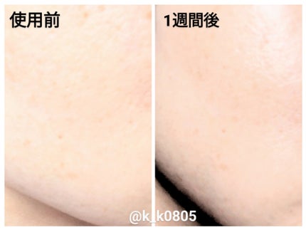 ピオニーペプチドクリーム/goodal/フェイスクリームを使ったクチコミ(4枚目)