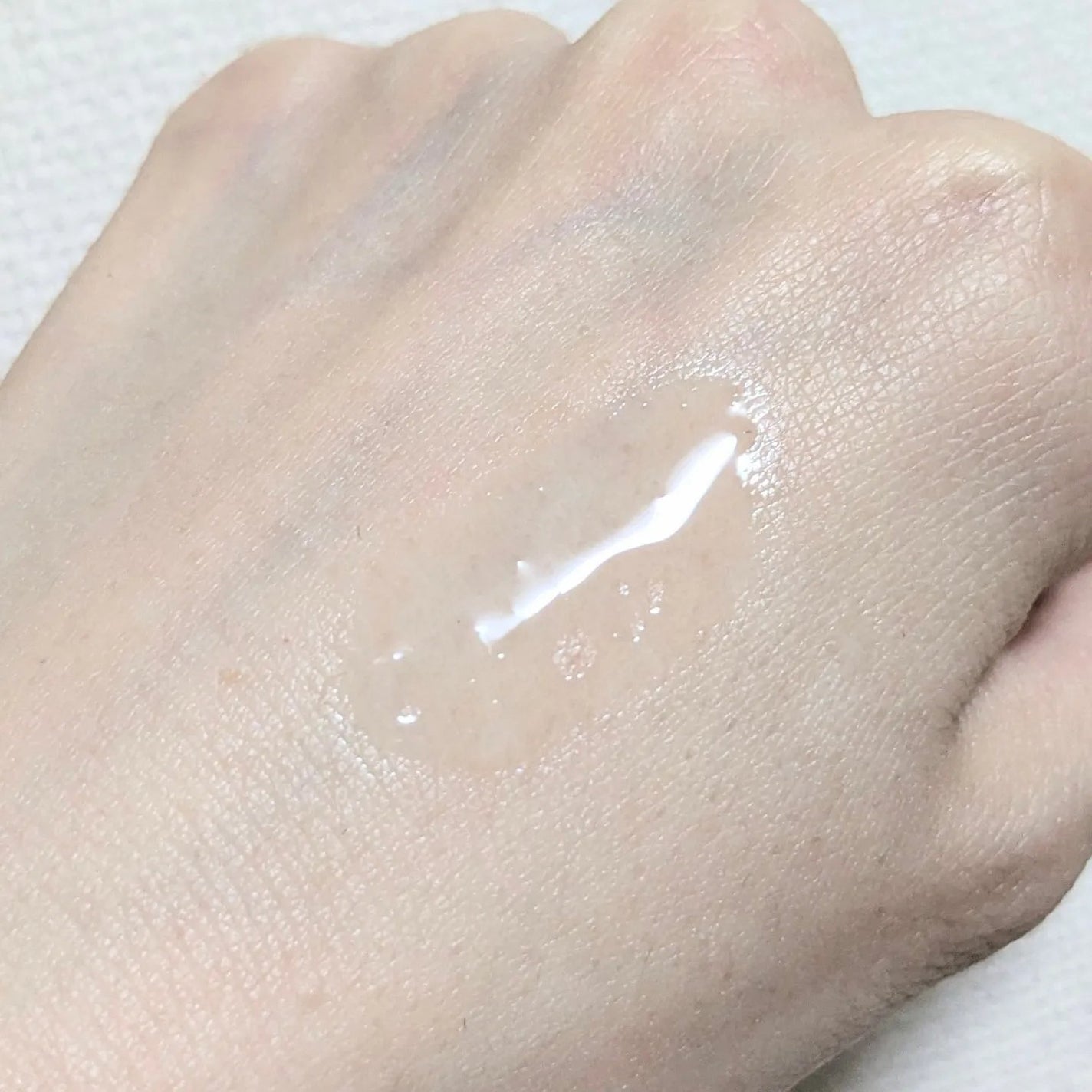 fractionalCC ニードルセラムC/fractionalCC/美容液を使ったクチコミ(3枚目)