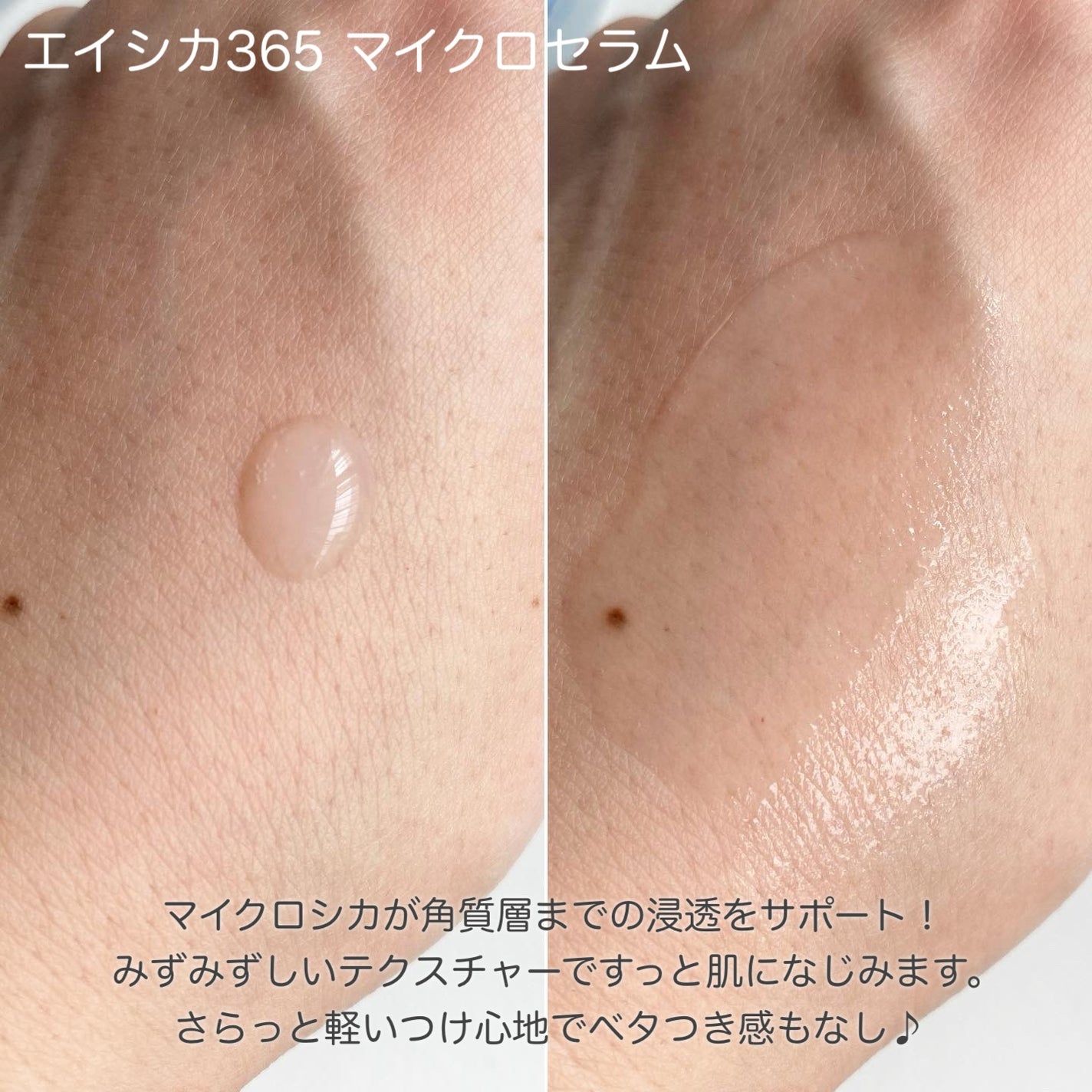 エイシカ365クイックマスクパッド/AESTURA/トナーパッドを使ったクチコミ(2枚目)