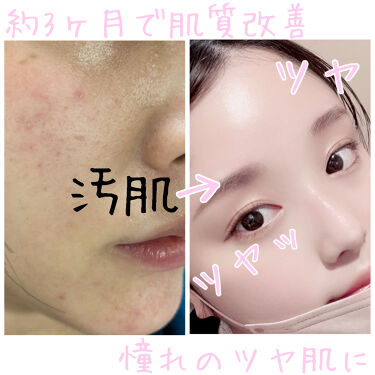 ツヤ肌 話題沸騰中のコスメ 真似したいメイク方法の口コミが件 デパコスからプチプラまで Lips