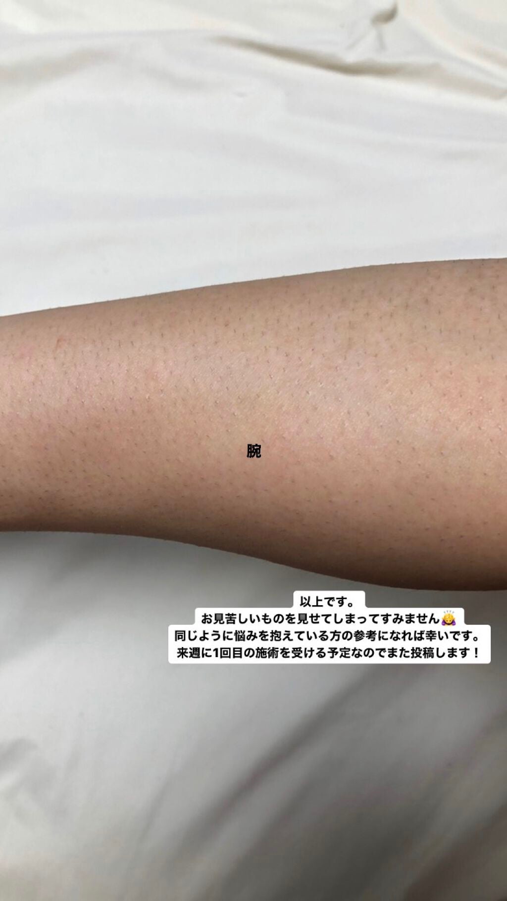 剛毛女 on LIPS 「⚠︎⚠︎⚠︎閲覧注意⚠︎⚠︎⚠︎すっごーーーーーく汚い写真です..」(8枚目)