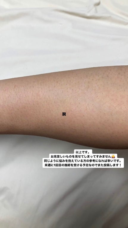 剛毛女 on LIPS 「⚠︎⚠︎⚠︎閲覧注意⚠︎⚠︎⚠︎すっごーーーーーく汚い写真です..」(8枚目)