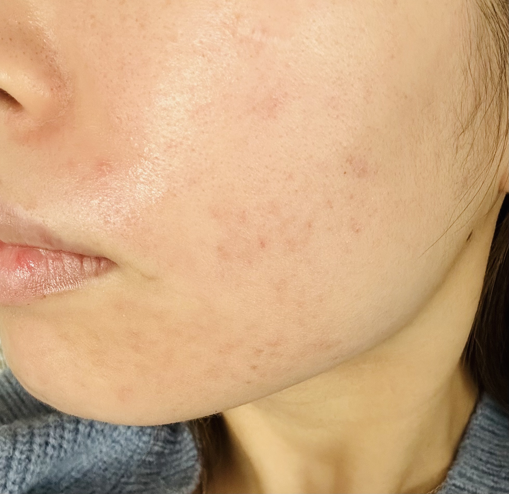 乾燥さん　薬用しっとり化粧液【医薬部外品】/乾燥さん/オールインワン化粧品を使ったクチコミ（1枚目）