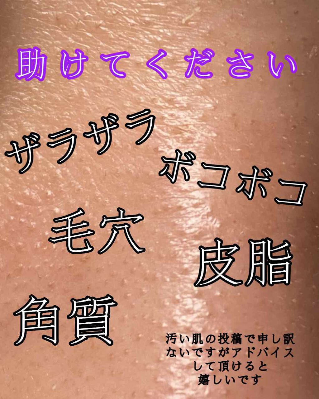 ロゼットゴマージュ/ロゼット/ピーリングを使ったクチコミ(1枚目)