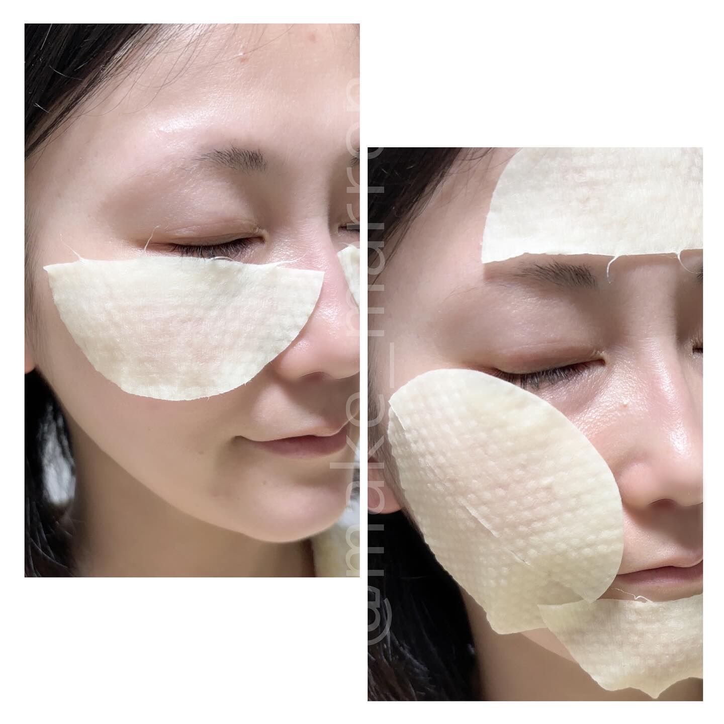 ヴィーガンビタミンブライトニングパッド/MEDIPEEL/トナーパッドを使ったクチコミ（3枚目）