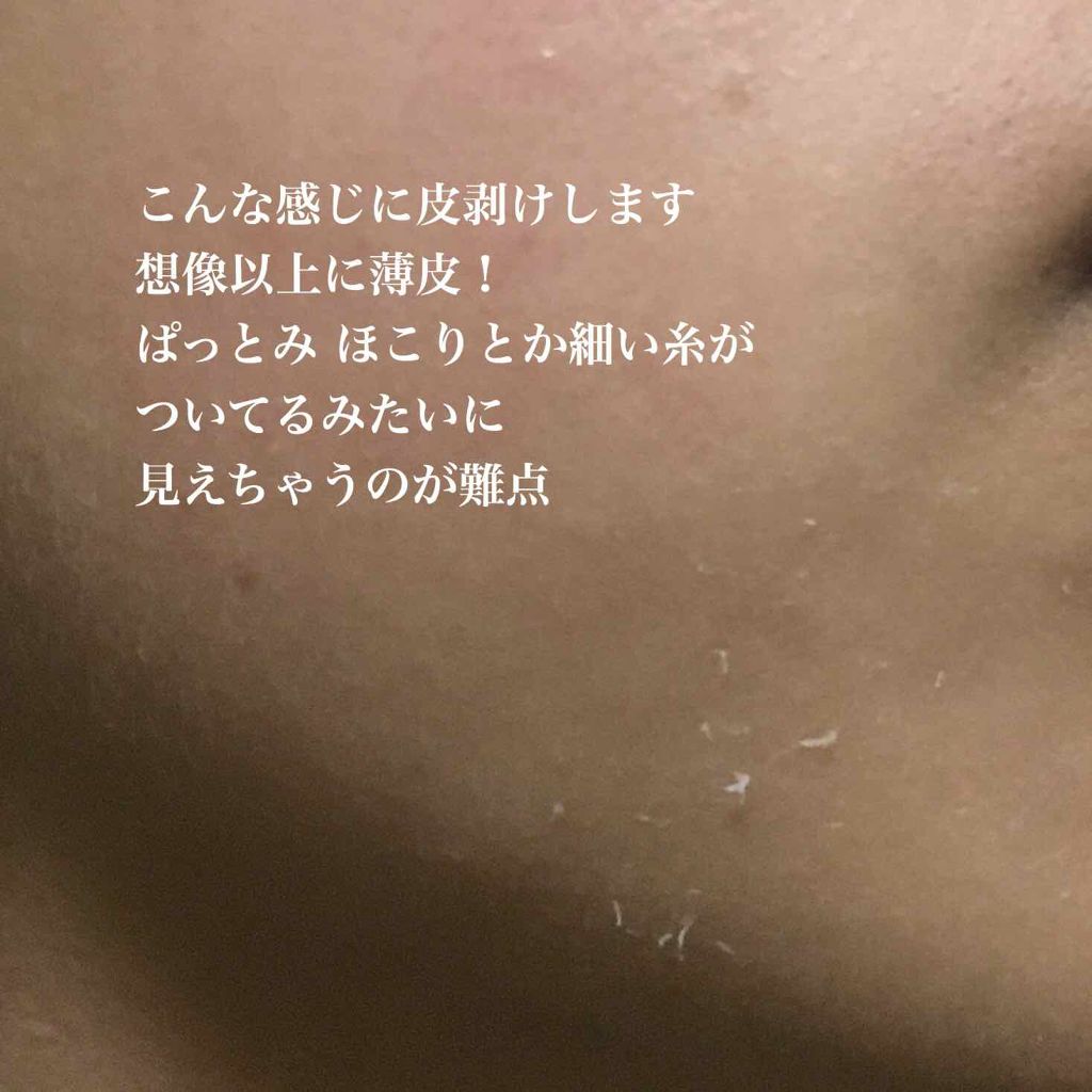 レチノールA 1% アドバンスドリバイタリゼーションクリーム/Life-flo/フェイスクリームを使ったクチコミ（3枚目）