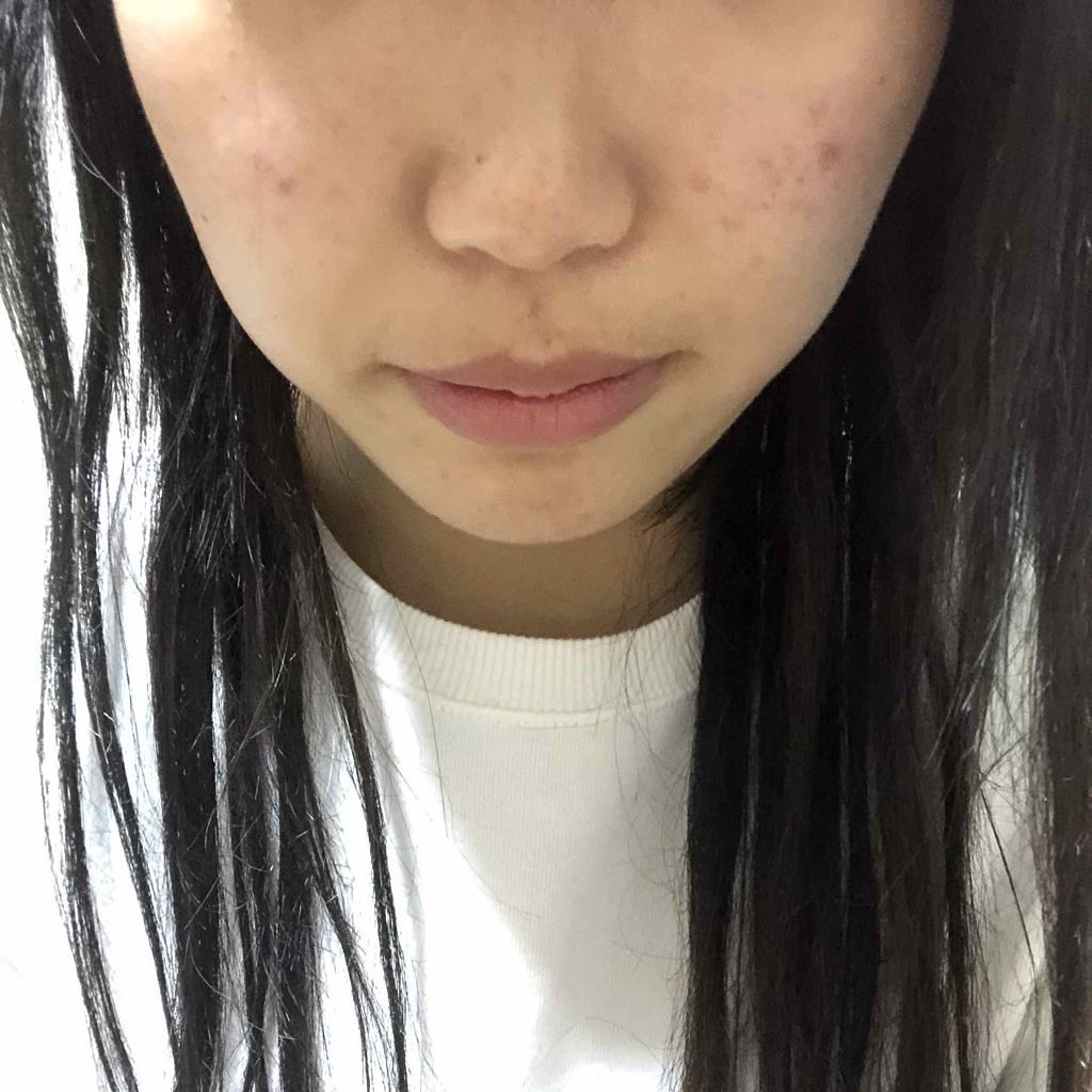 レッドコンシーラー/MEDICUBE/リキッドコンシーラーを使ったクチコミ(3枚目)