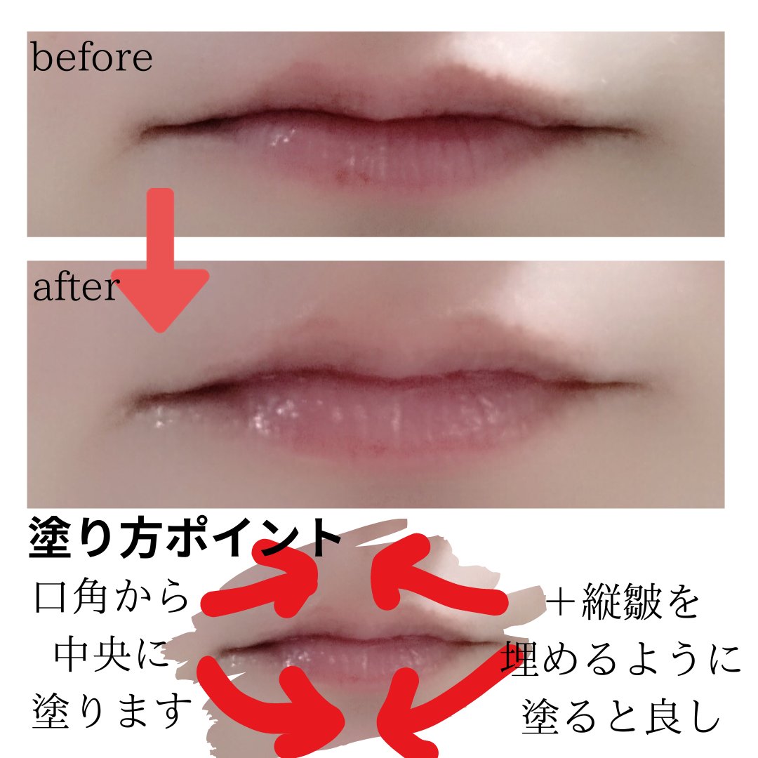 ハンド&リップ セラム セット/ALBLANC/その他キットセットを使ったクチコミ（2枚目）