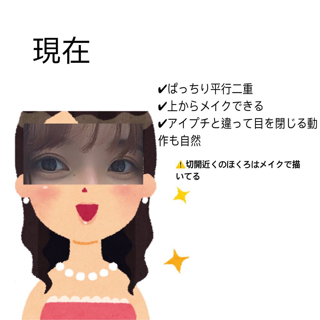 アイテープ片面(のびる)絆創膏タイプ スリム 120枚/セリア/二重まぶた用アイテムを使ったクチコミ(3枚目)