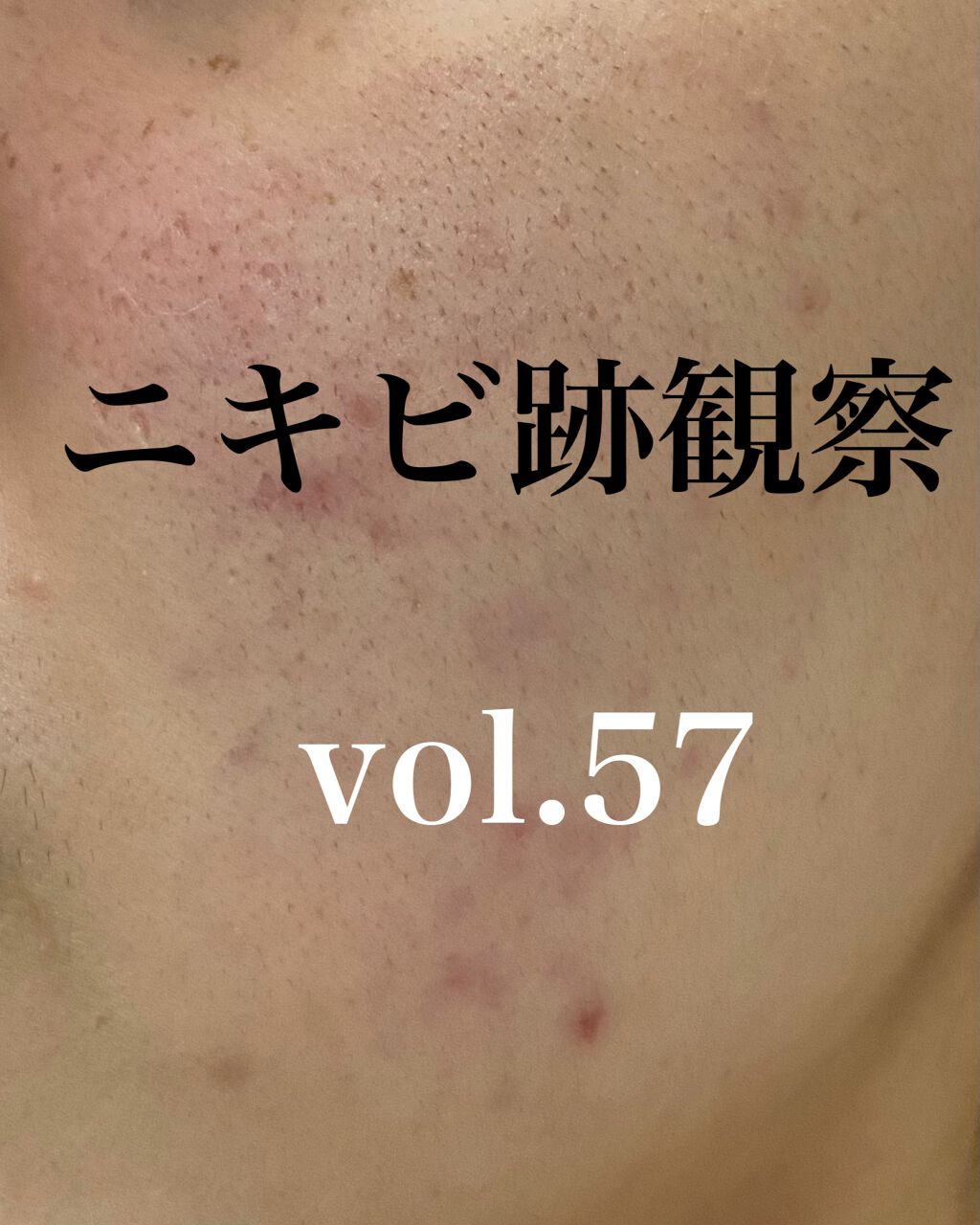 潤浸保湿 フェイスクリーム/キュレル/フェイスクリームを使ったクチコミ（1枚目）