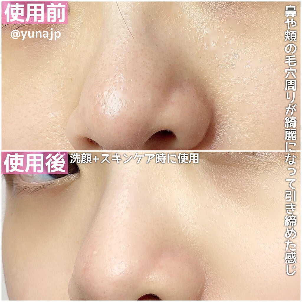 PLUMINUS/mous./美顔器・マッサージを使ったクチコミ(5枚目)