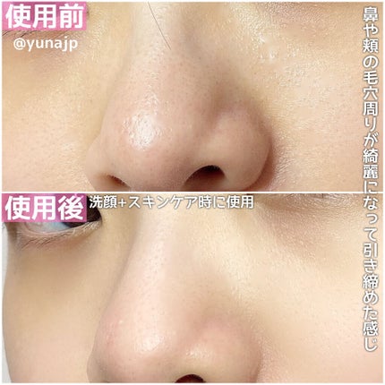 PLUMINUS/mous./美顔器・マッサージを使ったクチコミ(5枚目)