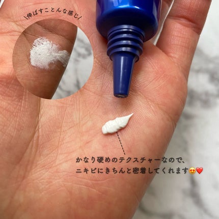 薬用ニキビケア スポッツクリーム/アクネスラボ/フェイスクリームを使ったクチコミ(3枚目)